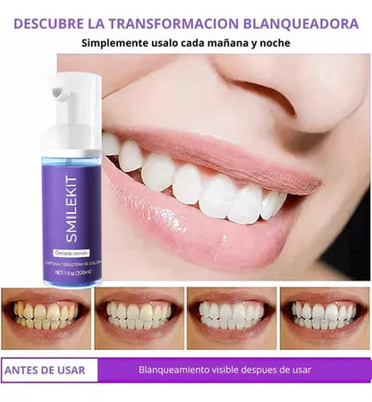 Compra 1 llévate 2 - QUEMA DE EXISTENCIAS HISMILE™ - Blanqueadora Dental Instantánea