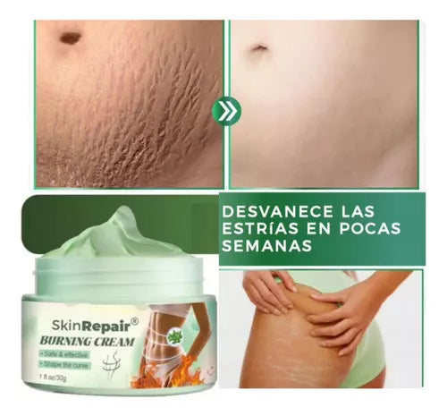 Compra 1 llévate 2 - ANTI ESTRÍAS Y CELULITIS SKIN REPAIR + ENVIO GRATIS