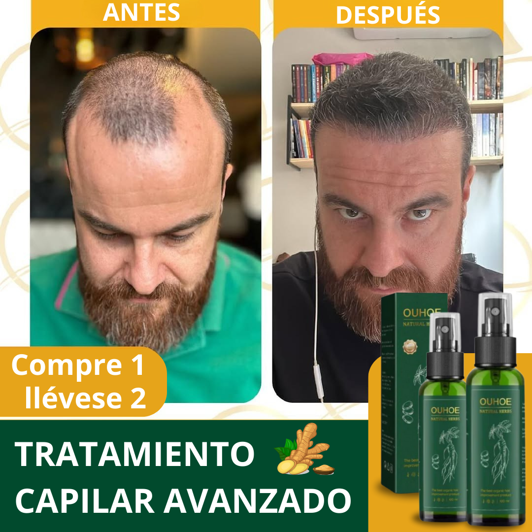 ¡50%! SPRAY GINGENG PARA CRECER EL PELO - PAGA 1 OTRO DE REGALO