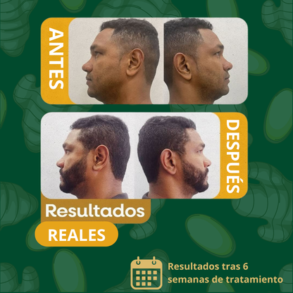 ¡50%! SPRAY GINGENG PARA CRECER EL PELO - PAGA 1 OTRO DE REGALO