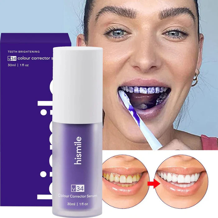 Compra 1 llévate 2 - QUEMA DE EXISTENCIAS HISMILE™ - Blanqueadora Dental Instantánea